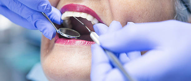 Best Emergency Tooth Extraction in Walterboro, SC